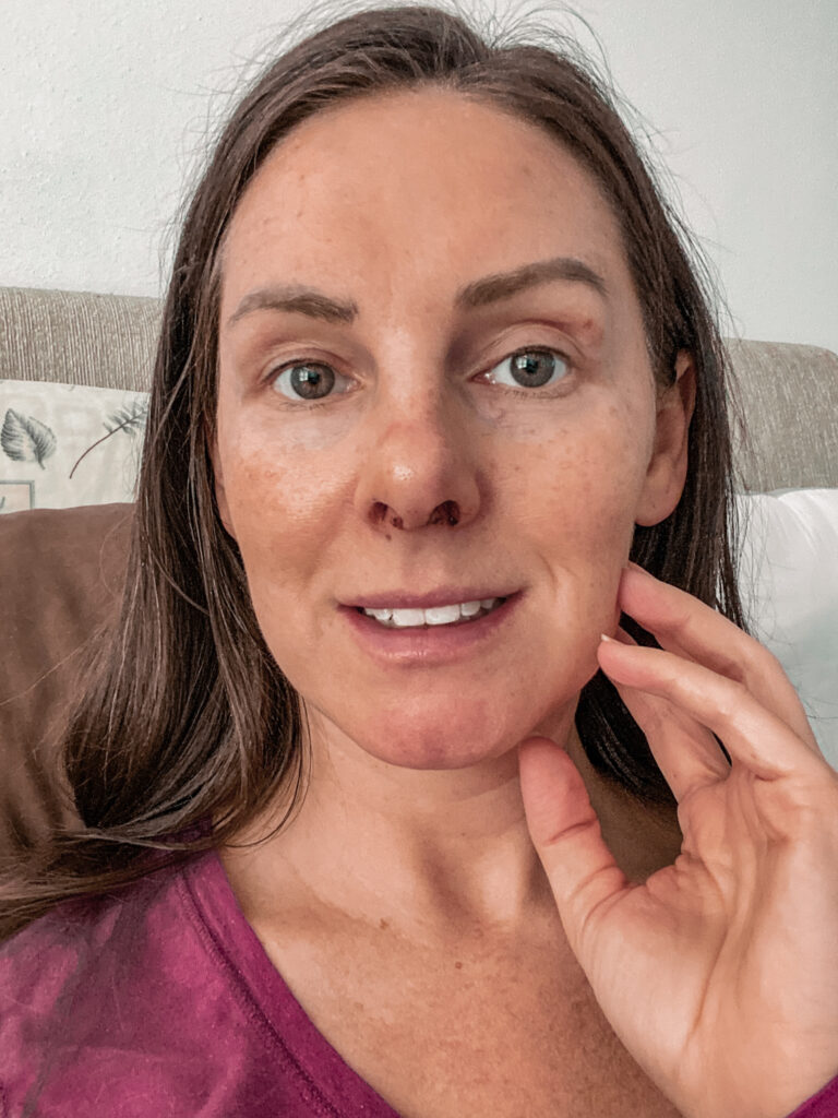 Brunette woman with hazel eyes sitting in bed smiling on day four of septoplasty recovery